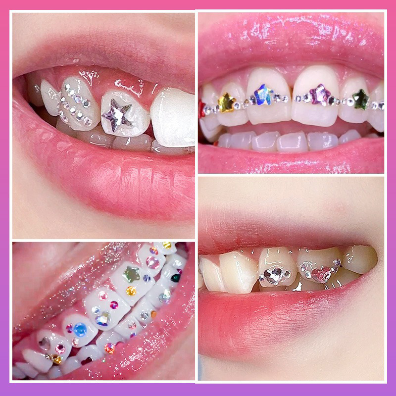 NEW Professional Tooth Gem Kit - Tooth Gem Kit 评论和价格
