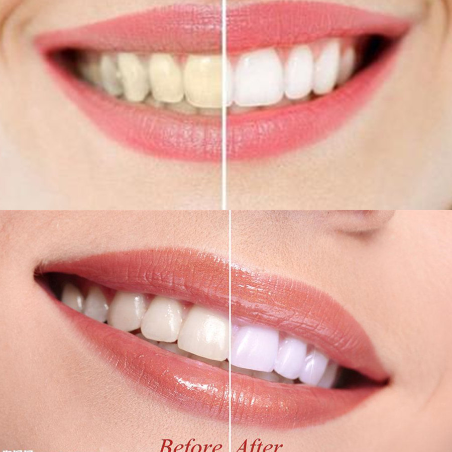 Bamboo Charcoal Teeth Tooth De - Teeth Whitening Singapore 评论和价格