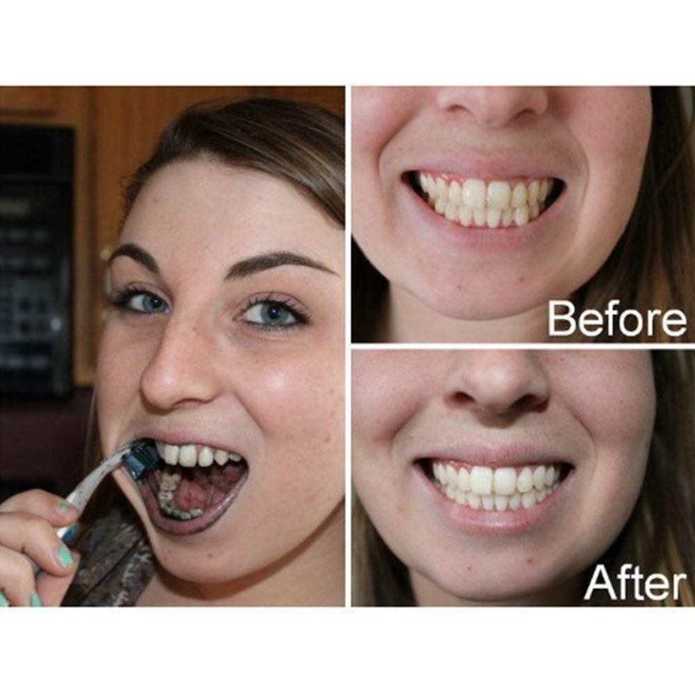 Bamboo Charcoal Teeth Tooth De - Teeth Whitening Singapore 评论和价格