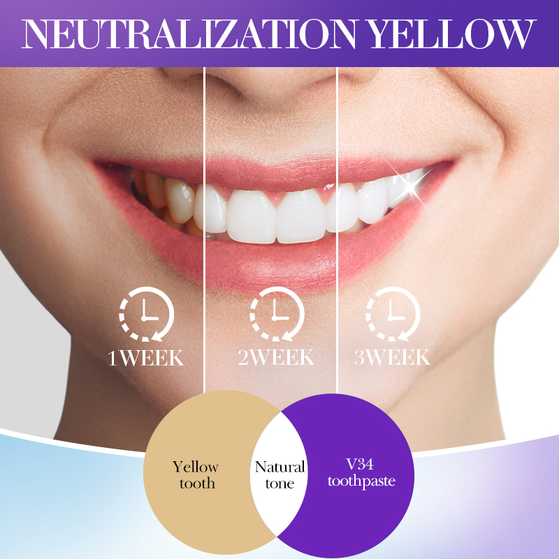 SADOER V34 Toothpaste Stain Re - Teeth Whitening Hismile 评论和价格