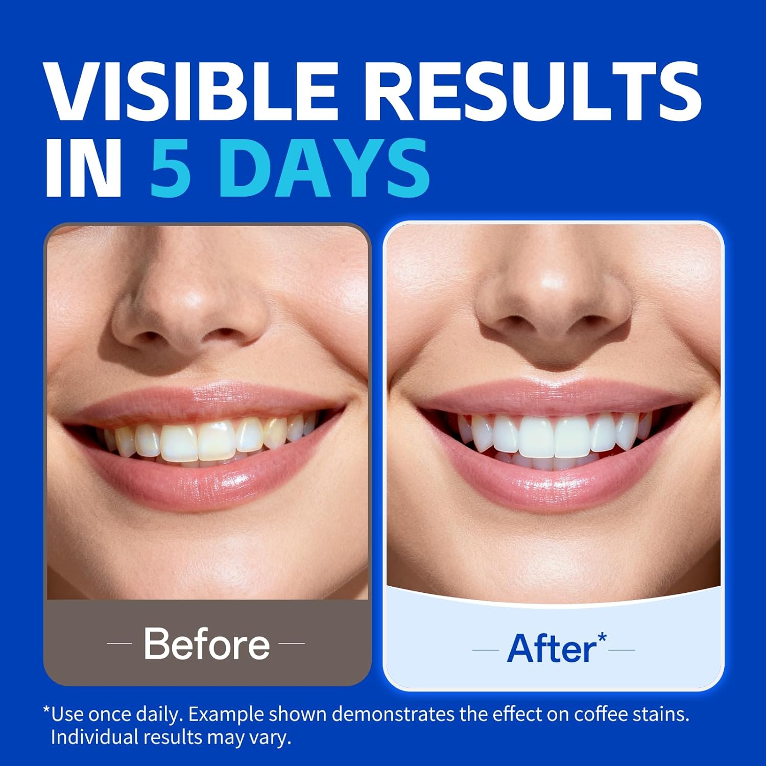 7 pairs Teeth Whitening Strips - Teeth Whitening Strips Permanent 评论和价格