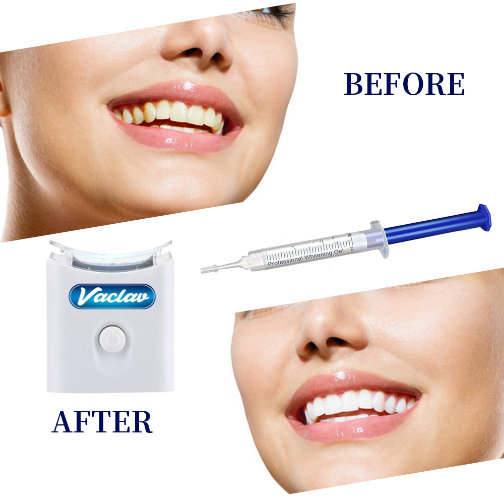 Mint Teeth Whitening Gel Syrin - Teeth Whitening Gel Syringes 评论和价格