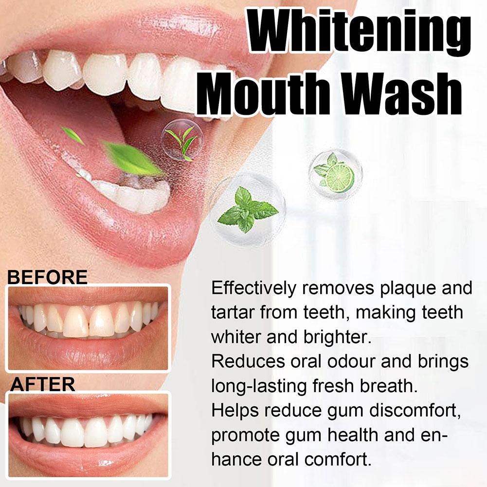 Coconut Mint Pulling Oil Mouth - Teeth Whitening Oil Pulling 评论和价格