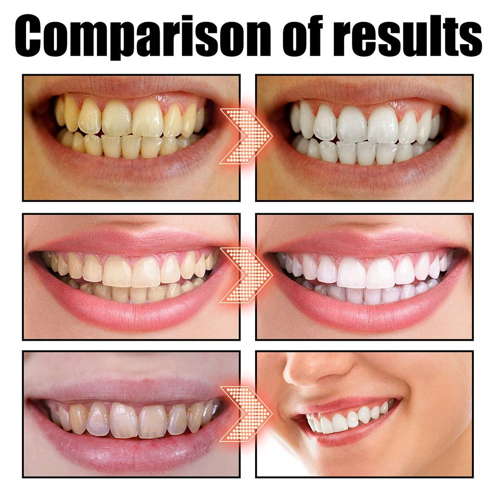 Coconut Mint Pulling Oil Mouth - Teeth Whitening Oil Pulling 评论和价格