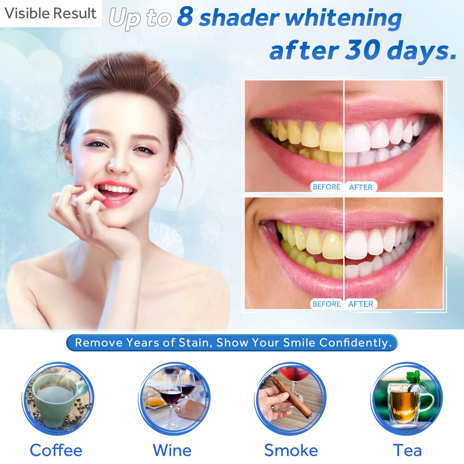 Teeth Whitening Gel Refill Syr - Teeth Whitening Hismile 评论和价格