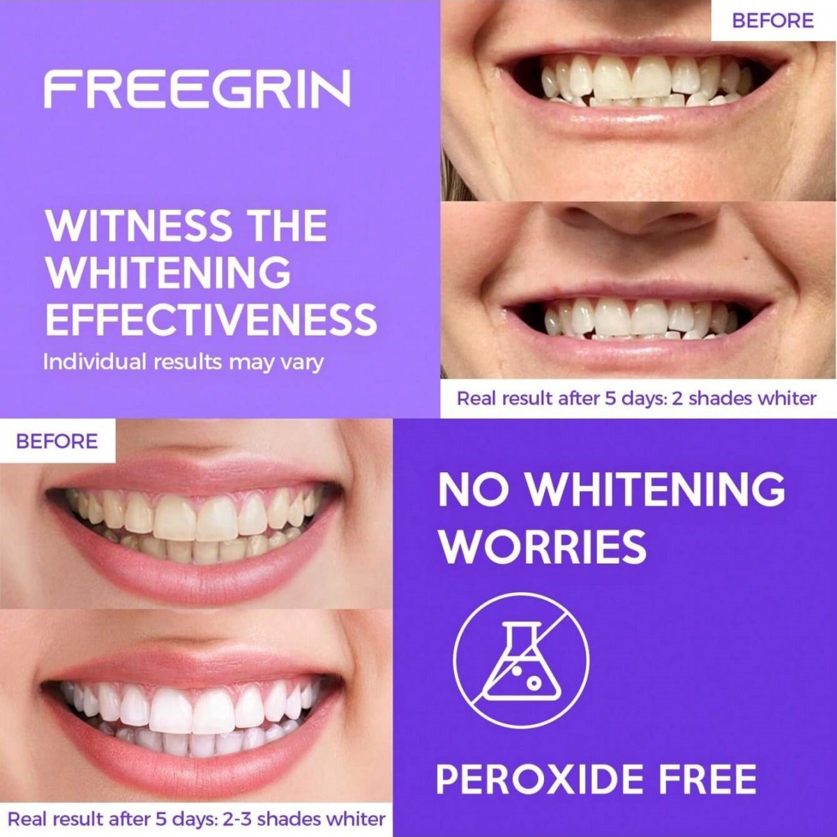 Deluxe Whitening Teeth Sticker - Teeth Whitening Strips Permanent 评论和价格