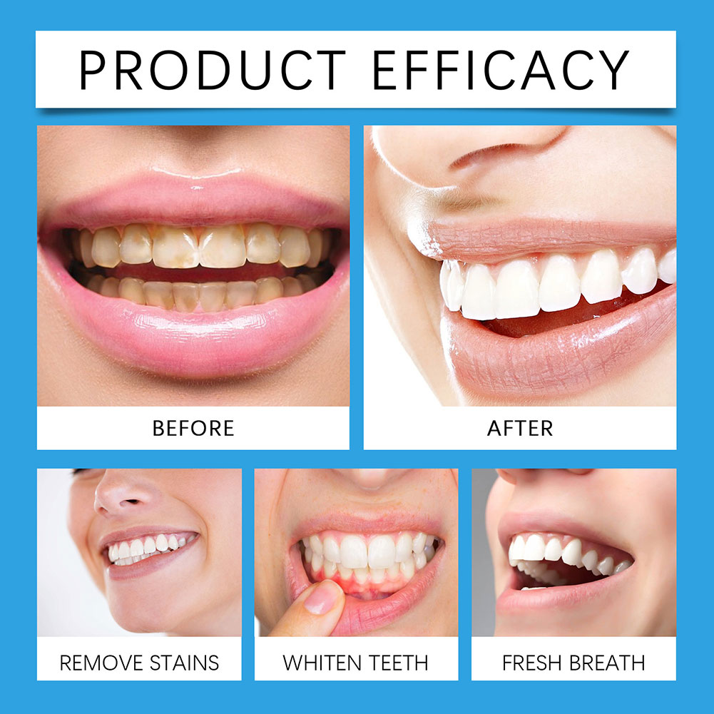 Professional Teeth Stain Remov - Teeth Whitening For Photos 评论和价格